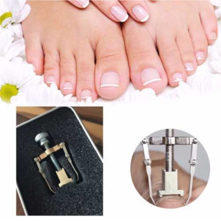 Corrector Uñero - Uña Encarnada